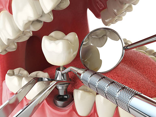  Sugarland Run, VA Emergency Dentist Pros